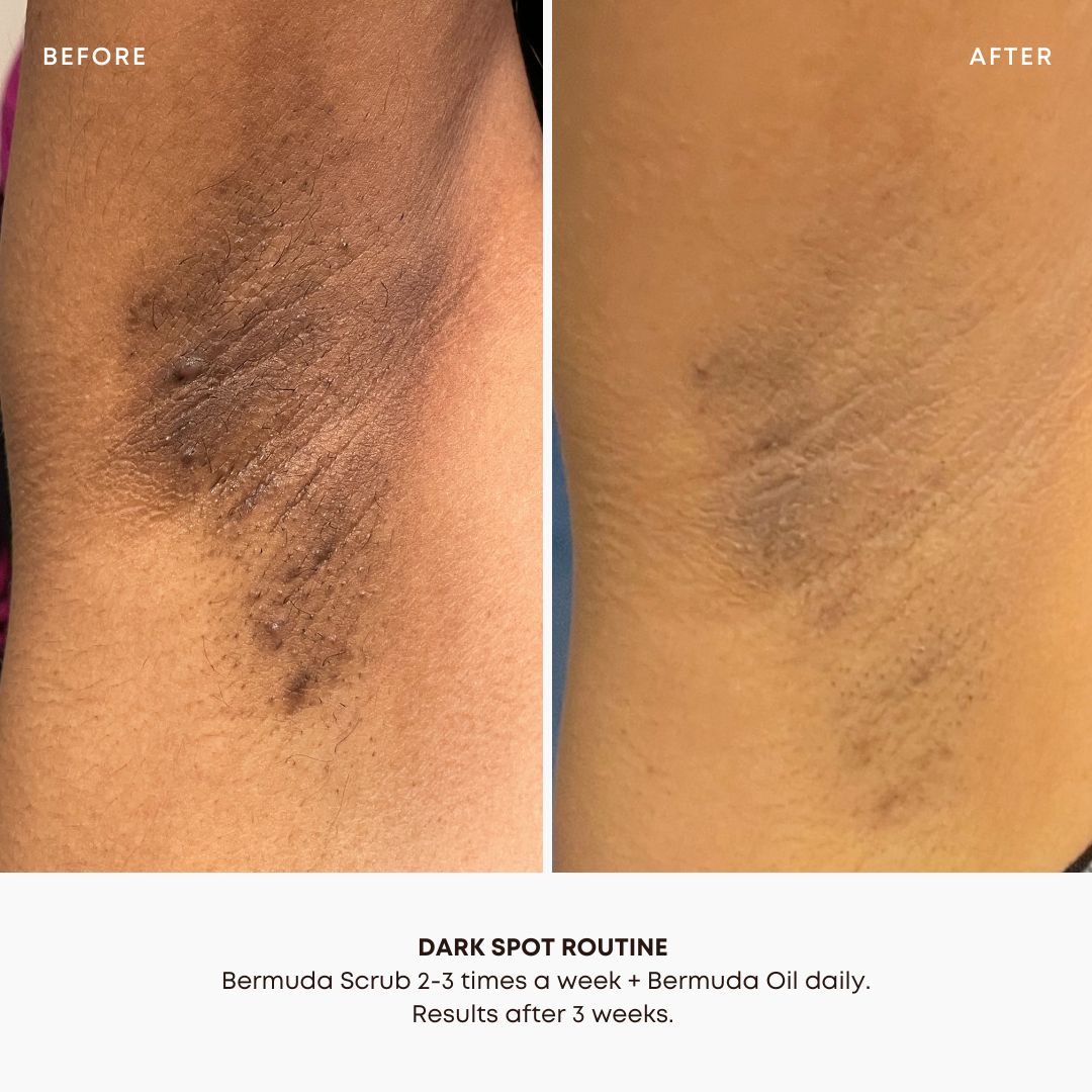 Bermuda Dark Spot 2 Step Routine - Image 6