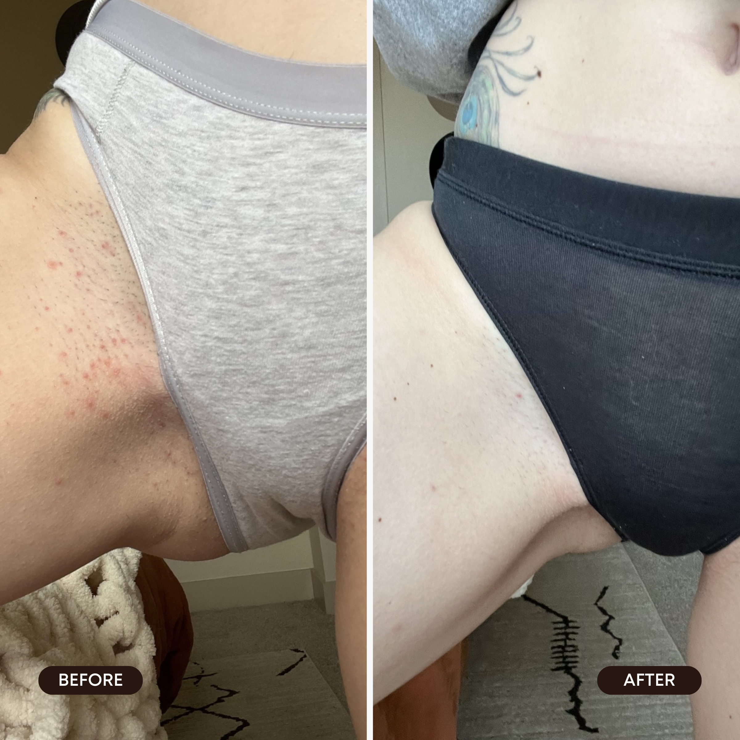 Berry Crush Ingrown Hair Exfoliating Scrub - Image 4