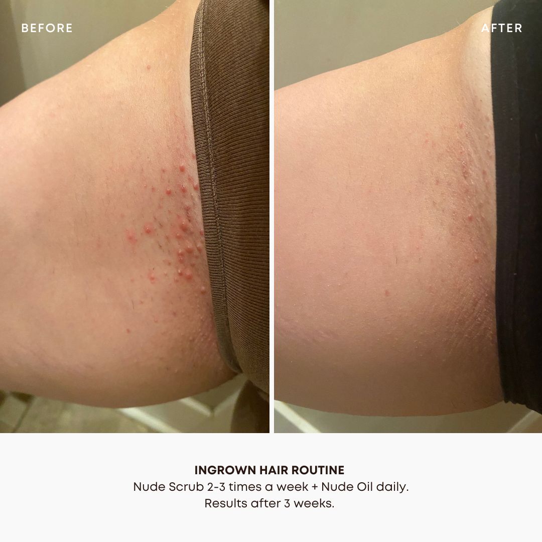 Bump Free Bundle - Image 8