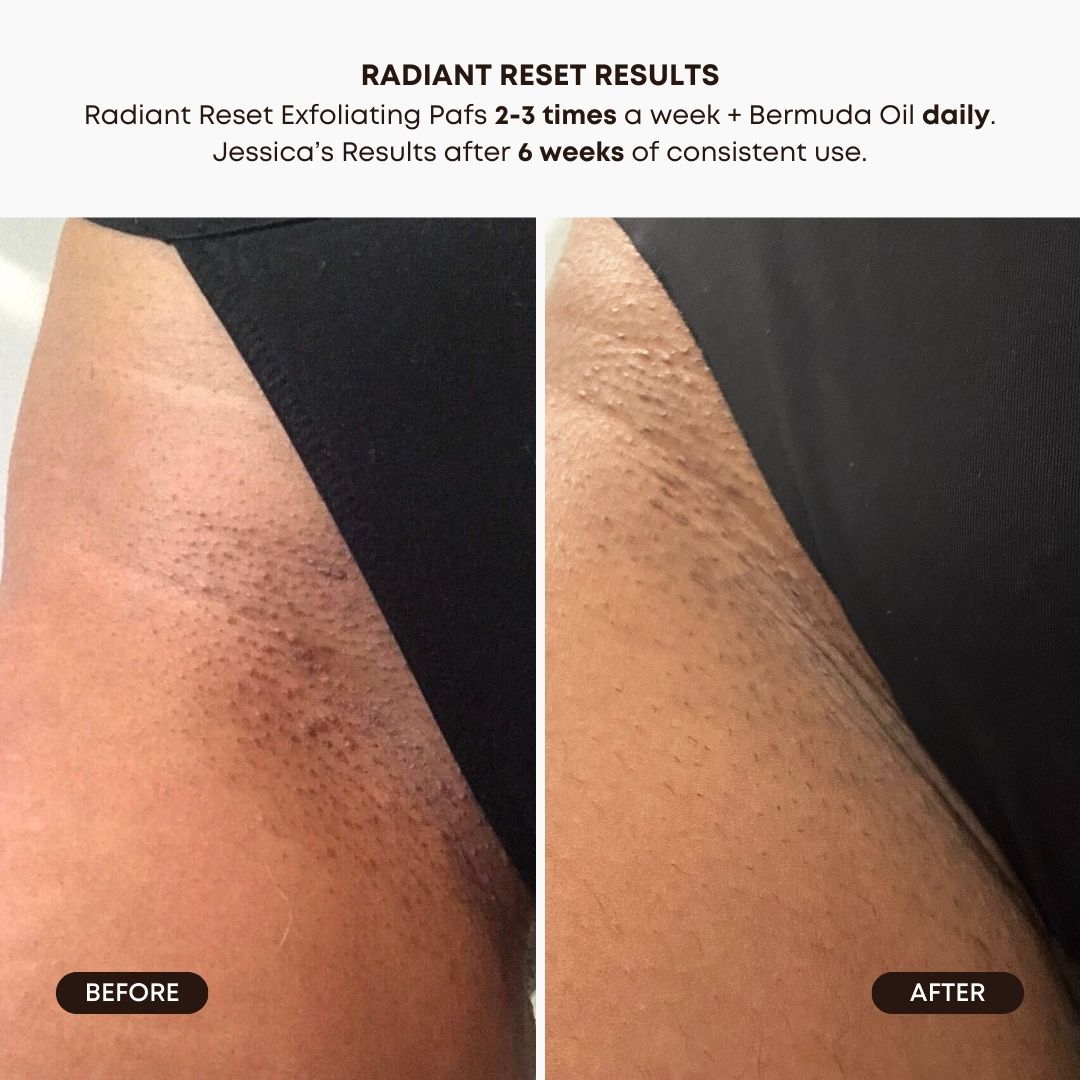 Radiant Reset Exfoliating Toner Pads - Image 3
