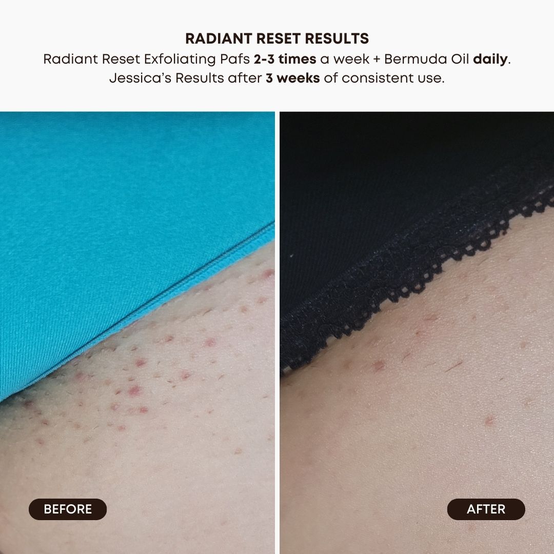 Radiant Reset Exfoliating Toner Pads - Image 8