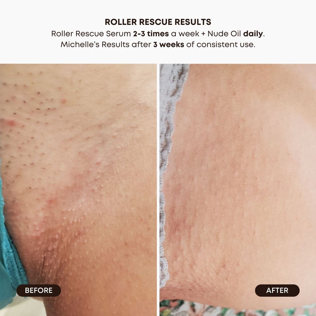 Roller Rescue Soothing Serum - Image 3